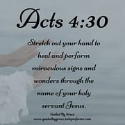 HEAL AND PERFORM MIRACULOUS SIGNS AND WONDERS /ACTS 4:30