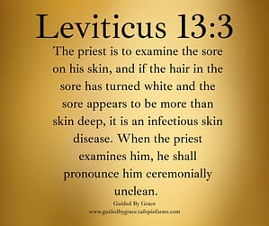 Leviticus 133