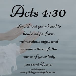 Acts 430